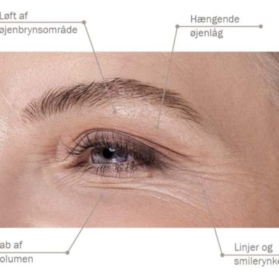 Fillerina® 12HA Specific Zones Eyes & Eyelids